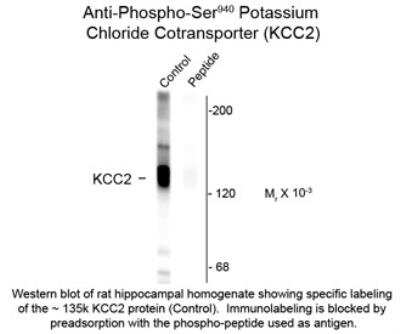 Western Blot: KCC2/SLC12A5 [p Ser940] Antibody [NBP2-29513]